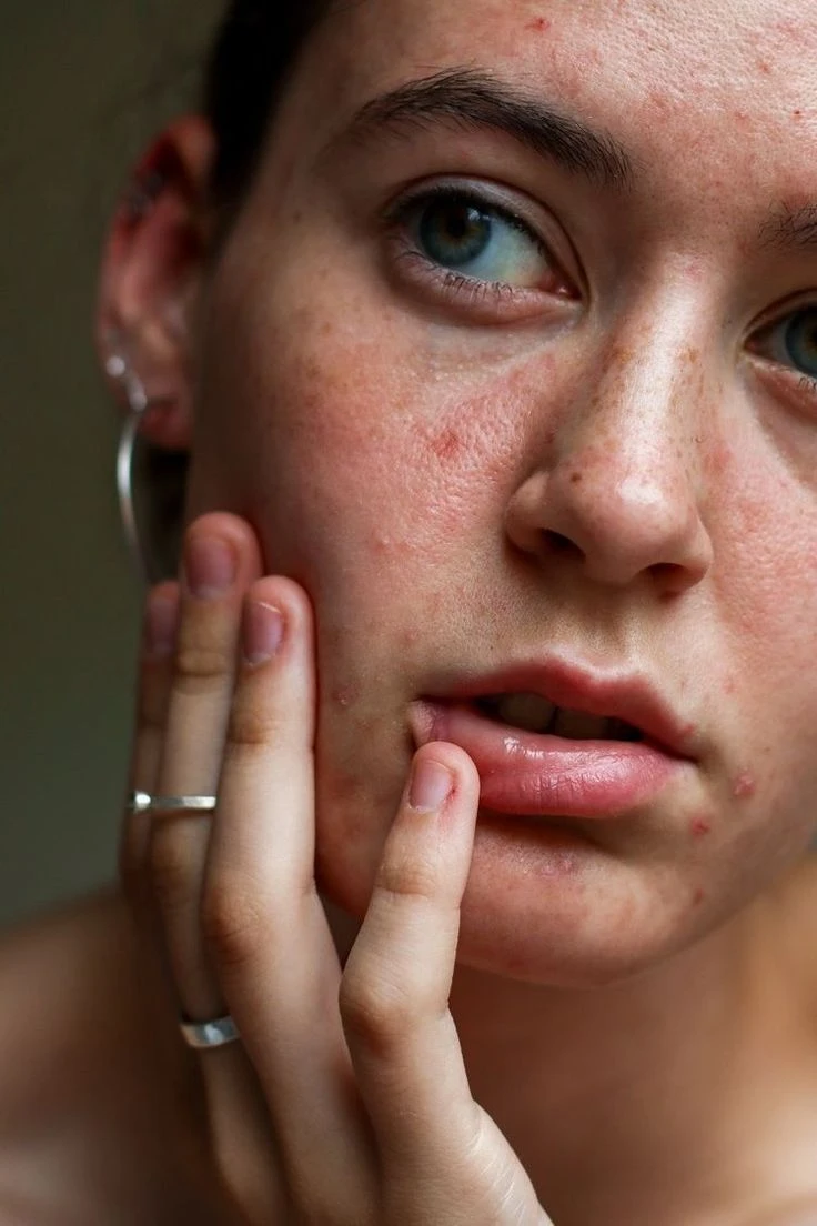 AI Blemish Remover Sample | VisualGPT