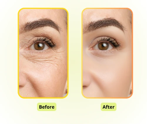 KI Faltenentferner: Effiziente Fotoretusche für Kreative